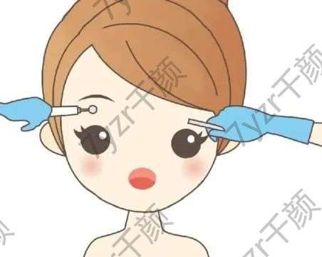 可以種植眉毛嗎